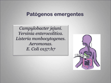 65